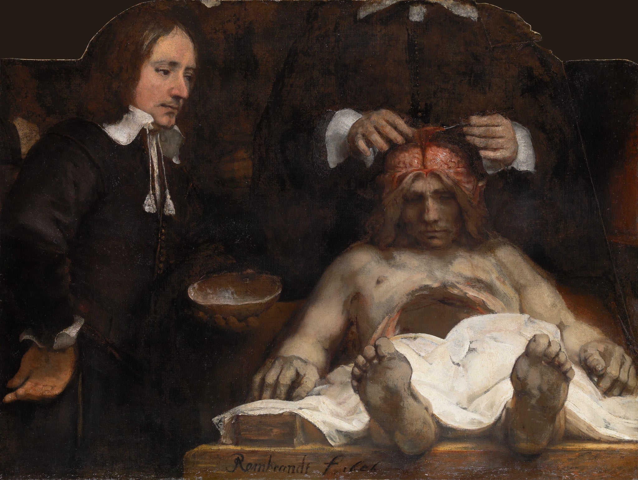 La Leçon d’anatomie du docteur Jan Deijman — Rembrandt